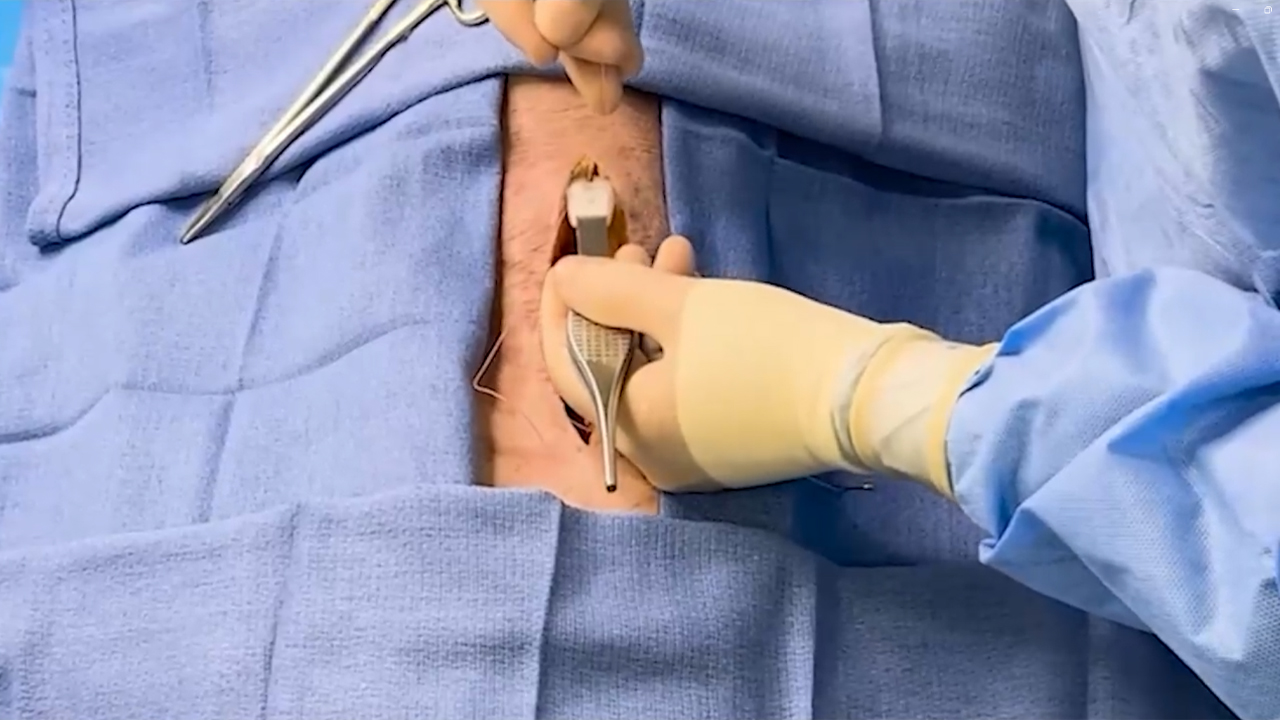 SureCut Demo